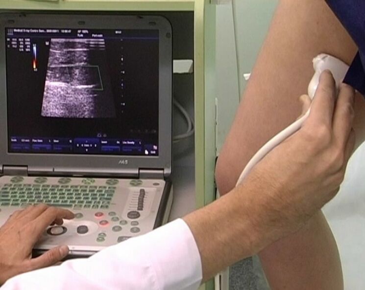 ultrazvuková diagnostika křečových žil pánve