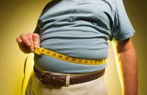 nadváha vyvolává rozvoj křečových žil